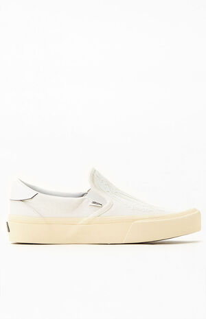 Ventura X-Ray image number 2