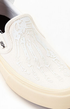 Ventura X-Ray image number 6